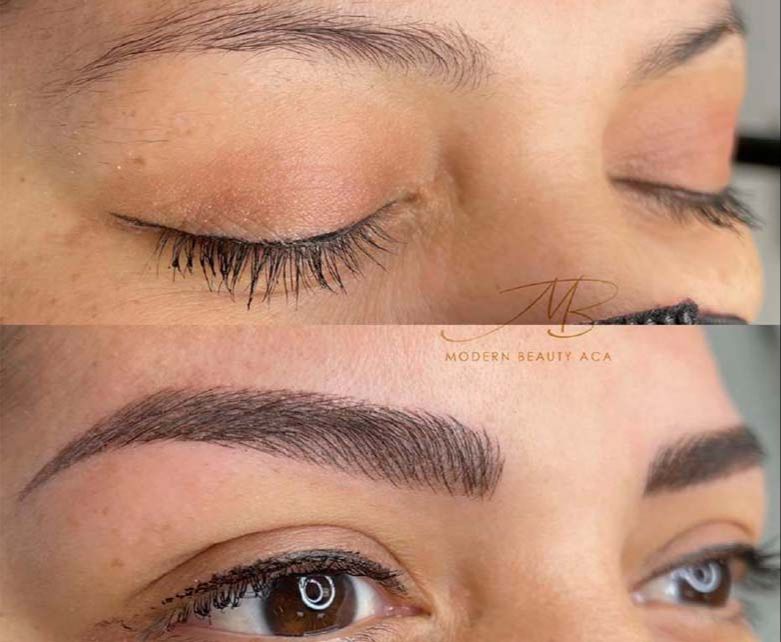 Resultado de cejas después del procedimiento