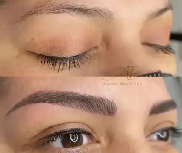Brow results gallery
