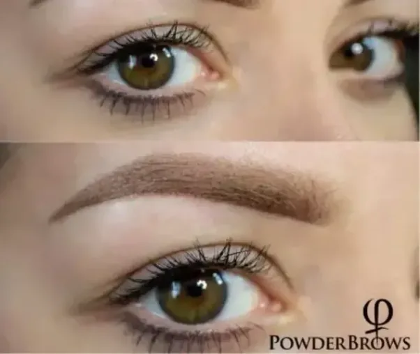 Brow results gallery