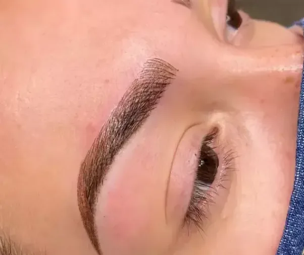 Brow results gallery